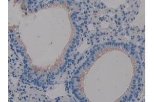 Immunohistochemistry (IHC) image for anti-Mucin 1 (MUC1) (AA 474-630) antibody (ABIN7442027)