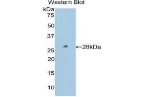 Western Blotting (WB) image for anti-HLA Class I Histocompatibility Antigen, alpha Chain E (HLA-E) (AA 22-358) antibody (ABIN1859818) (HLA-E antibody  (AA 22-358))