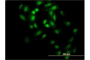 Immunofluorescence of monoclonal antibody to GABPA on HeLa cell. (GABPA antibody  (AA 1-100))