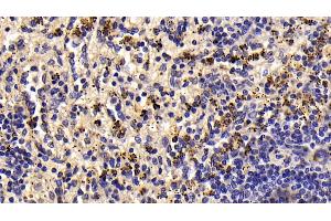 Detection of LTbR in Human Spleen Tissue using Monoclonal Antibody to Lymphotoxin Beta Receptor (LTbR) (LTBR antibody  (AA 66-215))