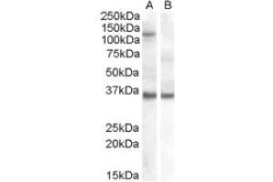 Image no. 1 for anti-Eukaryotic Translation Initiation Factor 2C, 1 (EIF2C1) (Internal Region) antibody (ABIN374655) (AGO1 antibody  (Internal Region))