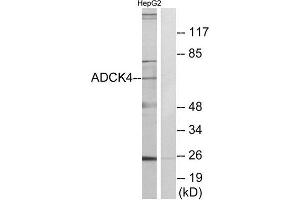 Western Blotting (WB) image for anti-AarF Domain Containing Kinase 4 (ADCK4) (N-Term) antibody (ABIN1849898) (ADCK4 antibody  (N-Term))