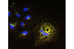 Transfected cell immunofluorescence staining N22/21=green, rabbit anti-Shank1=red, DAPI=blue.