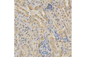 Immunohistochemistry of paraffin-embedded mouse kidney using ADD1 antibody at dilution of 1:200 (x400 lens)