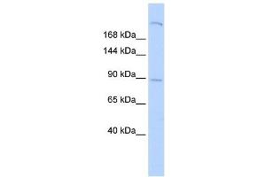 SHROOM2 antibody used at 1 ug/ml to detect target protein. (SHROOM2 antibody  (Middle Region))