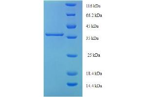 SDS-PAGE (SDS) image for Cytoglobin (CYGB) (AA 1-190), (full length) protein (His-SUMO Tag) (ABIN4974379)