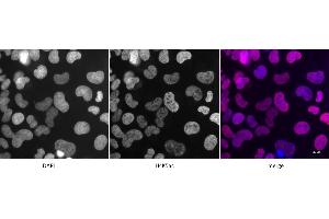 Detection of H4K5ac by immunofluorescence. (Histone H4 antibody  (acLys5))