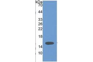 WB of Protein Standard: different control antibodies  against Highly purified E. (Vinculin ELISA Kit)
