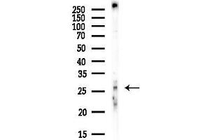 anti-Tissue Factor Pathway Inhibitor 2 (TFPI2) antibody