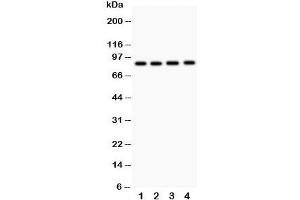 Western blot testing of NOX5 antibody and  Lane 1: 22RV1;  2: PANC;  3: HeLa;  4: SKOV. (NOX5 antibody  (C-Term))