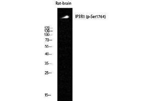 Western Blotting (WB) image for anti-Inositol 1,4,5-Trisphosphate Receptor, Type 1 (ITPR1) (pSer1764) antibody (ABIN3180459) (ITPR1 antibody  (pSer1764))