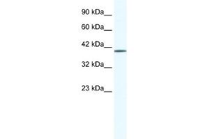 WB Suggested Anti-ZNF322A Antibody Titration:  0.