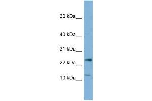 WB Suggested Anti-PPP1R11  Antibody Titration: 0. (PPP1R11 antibody  (N-Term))
