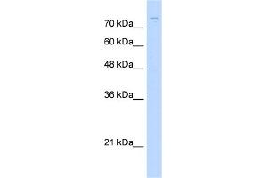 WB Suggested Anti-ZNF709 Antibody Titration:  1. (ZNF709 antibody  (N-Term))