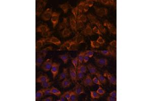 Immunofluorescence analysis of C6 cells using Sec23B antibody (ABIN7270169) at dilution of 1:100. (Sec23 Homolog B antibody  (AA 150-250))