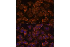 Immunofluorescence analysis of C6 cells using Sec23B antibody (ABIN7270169) at dilution of 1:100.