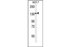 Western blot analysis of Peroxin 1 / PEX1 Antibody (Center) in MCF-7 cell line lysates (35ug/lane).