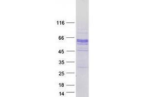 SPOCK2/Testican 2 Protein (Transcript Variant 2) (Myc-DYKDDDDK Tag)