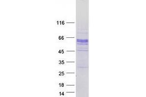 Validation with Western Blot (SPOCK2/Testican 2 Protein (Transcript Variant 2) (Myc-DYKDDDDK Tag))