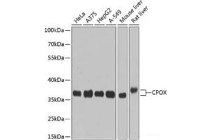 Western blot analysis of extracts of various cell lines using CPOX Polyclonal Antibody at dilution of 1:1000.