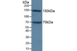 Detection of APOB in Porcine Liver Tissue using Polyclonal Antibody to Apolipoprotein B (APOB) (APOB antibody  (AA 3365-3548))
