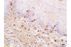 Formalin-fixed and paraffin embedded rat tongue labeled with Anti SynCAM/TSLC1 Polyclonal Antibody, Unconjugated (ABIN761351) at 1:200 followed by conjugation to the secondary antibody and DAB staining (CADM1 antibody  (AA 65-160))