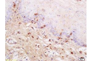 Formalin-fixed and paraffin embedded rat tongue labeled with Anti SynCAM/TSLC1 Polyclonal Antibody, Unconjugated (ABIN761351) at 1:200 followed by conjugation to the secondary antibody and DAB staining (CADM1 antibody  (AA 65-160))