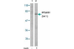 Western blot analysis of extracts from 293T cells untreated or treated with insulin (10ug/ml 15 min) using RPS6KB1 (phospho S411) polyclonal antibody . (RPS6KB1 antibody  (pSer411))