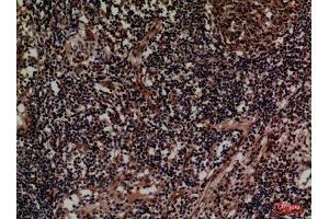 Immunohistochemistry (IHC) analysis of paraffin-embedded Human Lymph, antibody was diluted at 1:100. (CD1d antibody  (Internal Region))