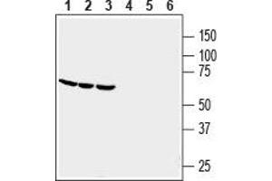 Western blot analysis of human THP-1 monocytic leukemia (lanes 1 and 4), human HL-60 promyelocytic leukemia (lanes 2 and 5) and human U-87 MG glioblastoma (lanes 3 and 6) cell line lysates: - 1-3. (GPR84 antibody  (Extracellular))