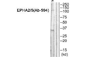 Western blot analysis of extracts from JK cells, using EPHA2/5 (Ab-594) Antibody. (EPHA2/5 (Tyr594) antibody)