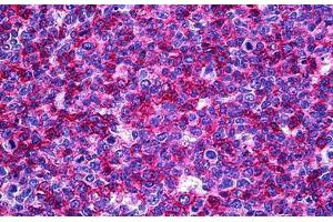 Human Tonsil: Formalin-Fixed, Paraffin-Embedded (FFPE) (USP33 antibody  (AA 327-427))