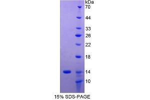 SDS-PAGE analysis of Human MHCG Protein. (HLAG Protein)