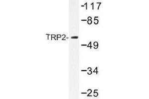 Image no. 1 for anti-Dopachrome Tautomerase (DCT) antibody (ABIN317917) (DCT antibody)