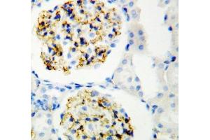 IHC-P: CD34 antibody testing of rat kidney (CD34 antibody  (C-Term))
