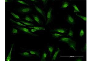 Immunofluorescence of purified MaxPab antibody to ZCRB1 on HeLa cell. (ZCRB1 antibody  (AA 1-217))