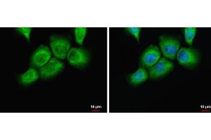 ICC/IF Image uPAR antibody detects uPAR protein at cytoplasm by immunofluorescent analysis. (PLAUR antibody)