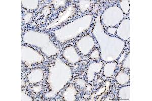 IHC analysis of HDAC2 using anti-HDAC2 antibody (ABIN7601564).
