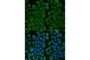 Immunofluorescence analysis of U2OS cells using TKT antibody. (TKT antibody  (AA 1-280))