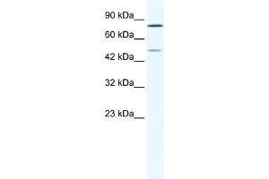 Western Blot showing ZNF12 antibody used at a concentration of 1-2 ug/ml to detect its target protein. (ZNF12 antibody  (N-Term))