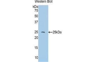Western blot analysis of the recombinant protein. (CD8 alpha antibody  (AA 26-236))