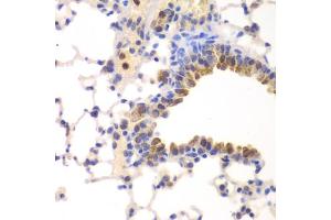 Immunohistochemistry of paraffin-embedded mouse lung using NFKB1 antibody (ABIN5974018) at dilution of 1/100 (40x lens). (NFKB1 antibody)