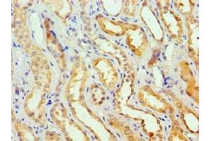 Immunohistochemistry of paraffin-embedded human kidney tissue using ABIN7154092 at dilution of 1:100 (GSTa2 antibody  (AA 1-222))