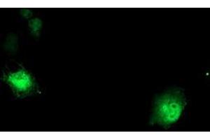 Anti-DTNB mouse monoclonal antibody (ABIN2455583) immunofluorescent staining of COS7 cells transiently transfected by pCMV6-ENTRY DTNB (RC203798). (Dystrobrevin beta antibody)