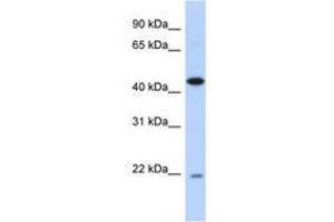 Image no. 1 for anti-RNA-Binding Protein NOB1 (NOB1) (AA 35-84) antibody (ABIN6741274) (NOB1 antibody  (AA 35-84))