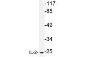 Western blot analysis of IL-2 antibody in extracts from HT-29 cells. (IL-2 antibody)