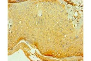 Immunohistochemistry of paraffin-embedded human skin tissue using ABIN7148493 at dilution of 1:100
