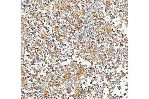 IHC analysis of CP110 using anti-CP110 antibody (ABIN5693312). (CP110 antibody  (AA 51-284))