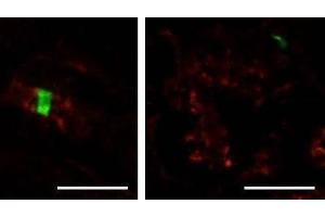 Adult rat sciatic nerve immunofluorescence staining: paranodes labeled with N244/5 (red) surround nodes of Ranvier labeled with Beta-IV spectrin (green) (image on right is cross-section of a similar image of left).