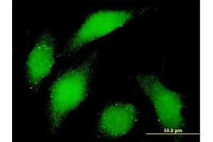 Immunofluorescence (IF) image for anti-Budding Uninhibited By Benzimidazoles 1 Homolog (Yeast) (BUB1) (AA 1-1085) antibody (ABIN560106)